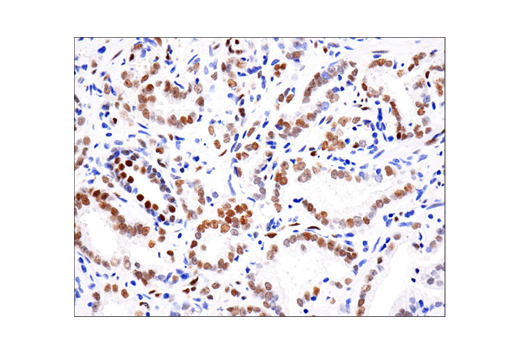 Phospho Stat Tyr D A Xp Rabbit Mab Bsa And Azide Free