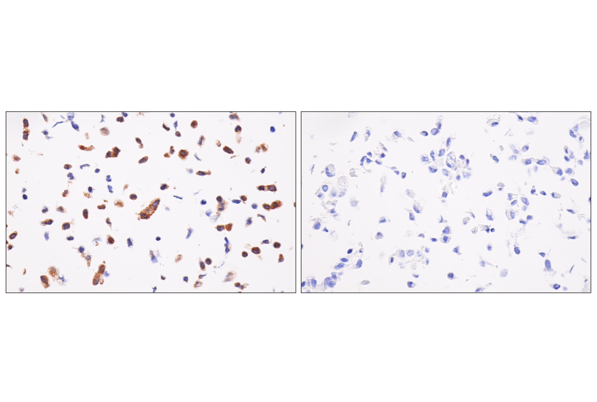 ENTPD5 E5U3V Rabbit MAb Cell Signaling Technology