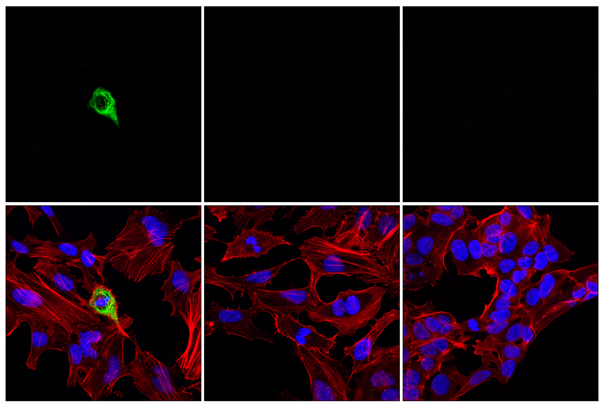 Immunofluorescence Image 1: Phospho-Vimentin (Ser56) (D5H2) Rabbit mAb