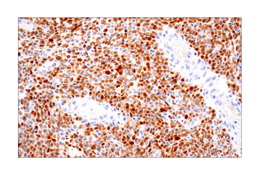 Immunohistochemistry Image 1: Sox9 (D8G8H) Rabbit mAb (BSA and Azide Free)