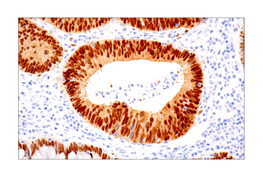 Immunohistochemistry Image 2: Sox9 (D8G8H) Rabbit mAb (BSA and Azide Free)