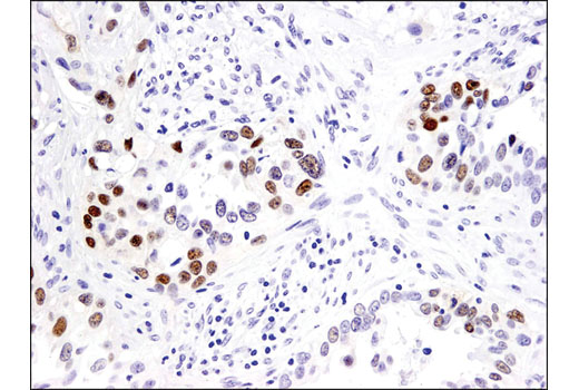 Immunohistochemistry Image 4: Sox9 (D8G8H) Rabbit mAb (BSA and Azide Free)