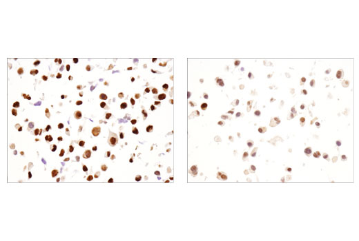 Immunohistochemistry Image 6: Sox9 (D8G8H) Rabbit mAb (BSA and Azide Free)
