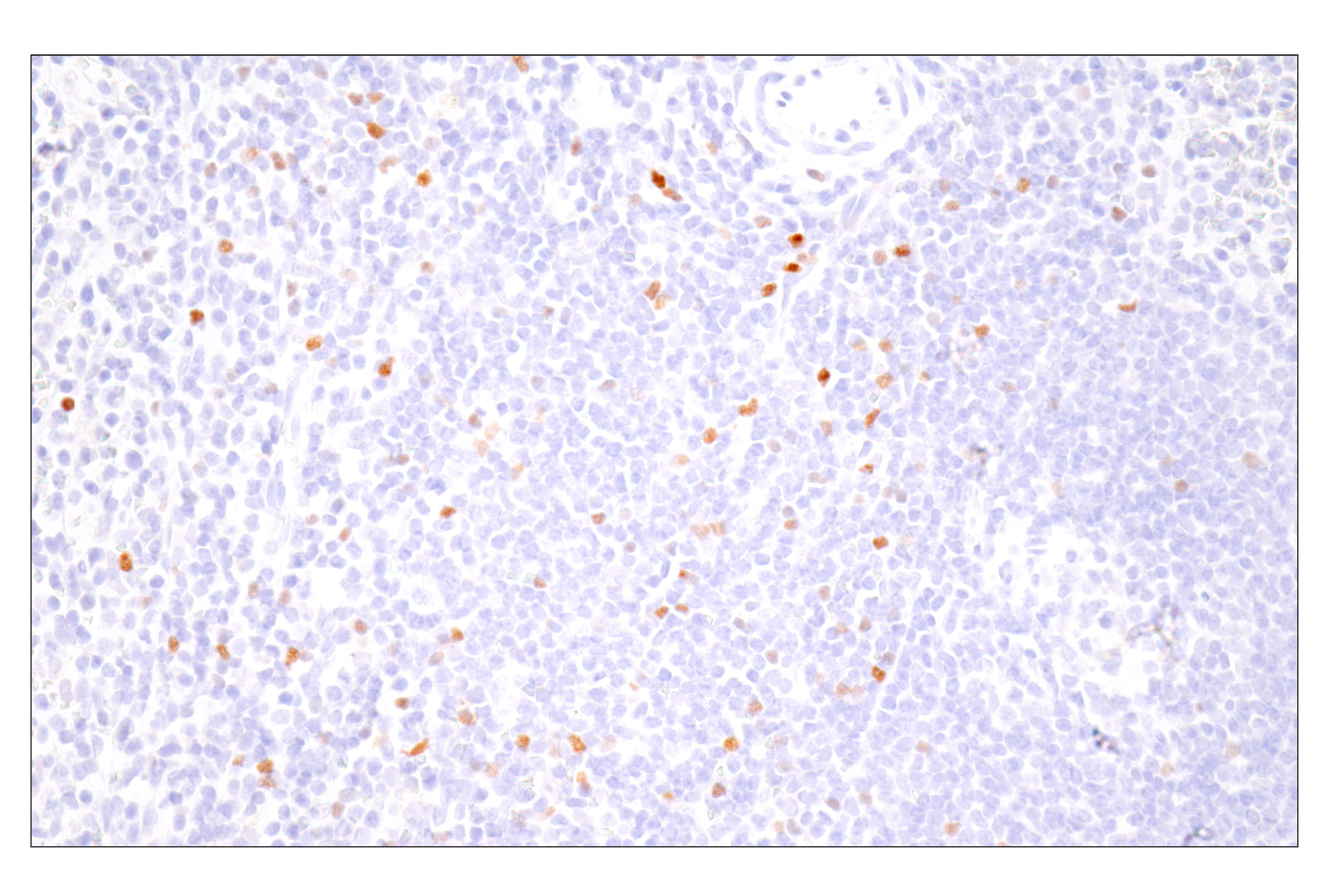 Immunohistochemistry Image 4: FoxP3 (D2W8E™) Rabbit mAb (BSA and Azide Free)