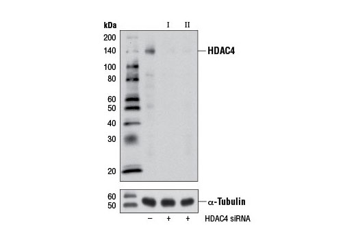  Image 1: SignalSilence® HDAC4 siRNA II
