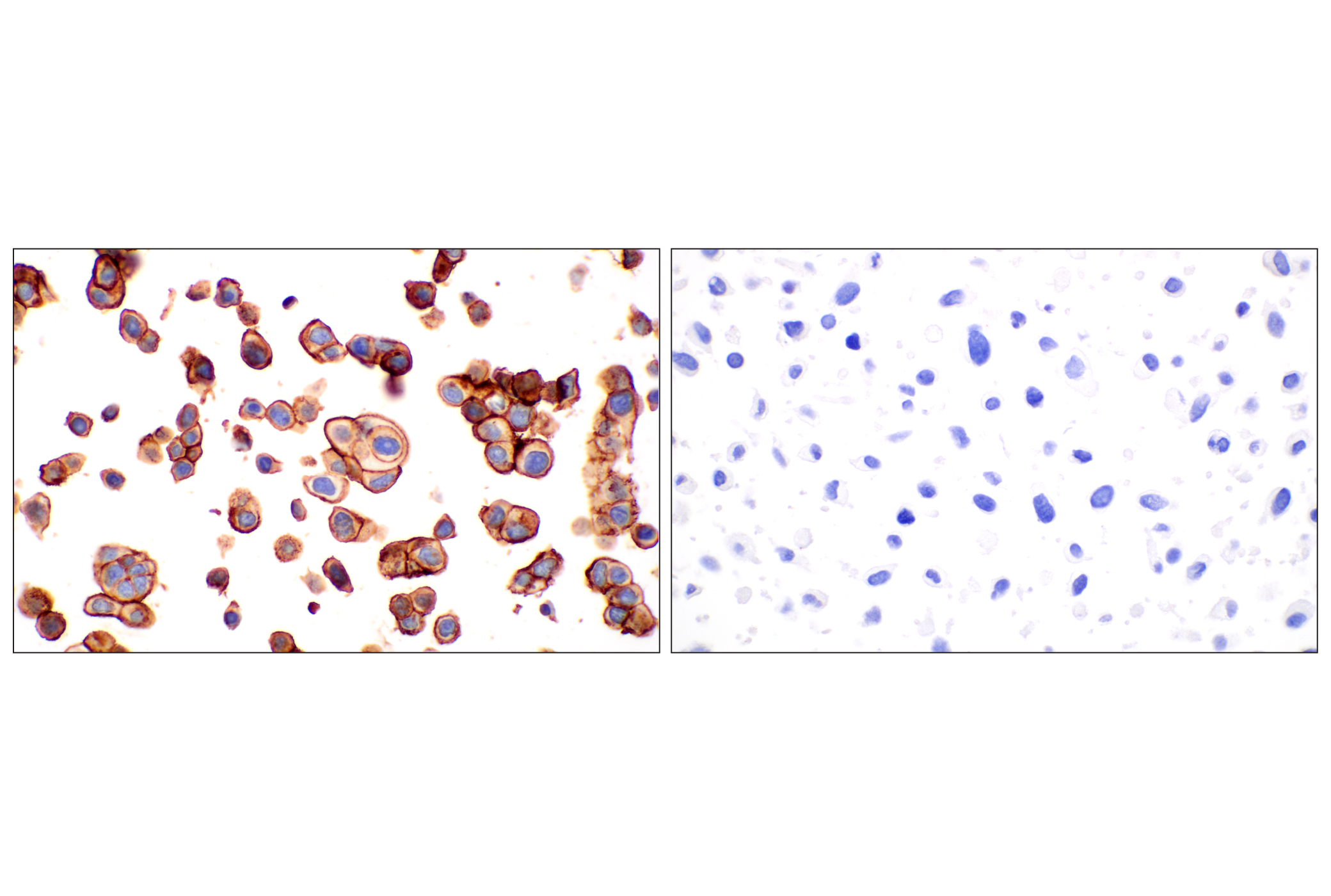 Immunohistochemistry Image 14: TACSTD2/TROP2 (F4W4J) Rabbit mAb