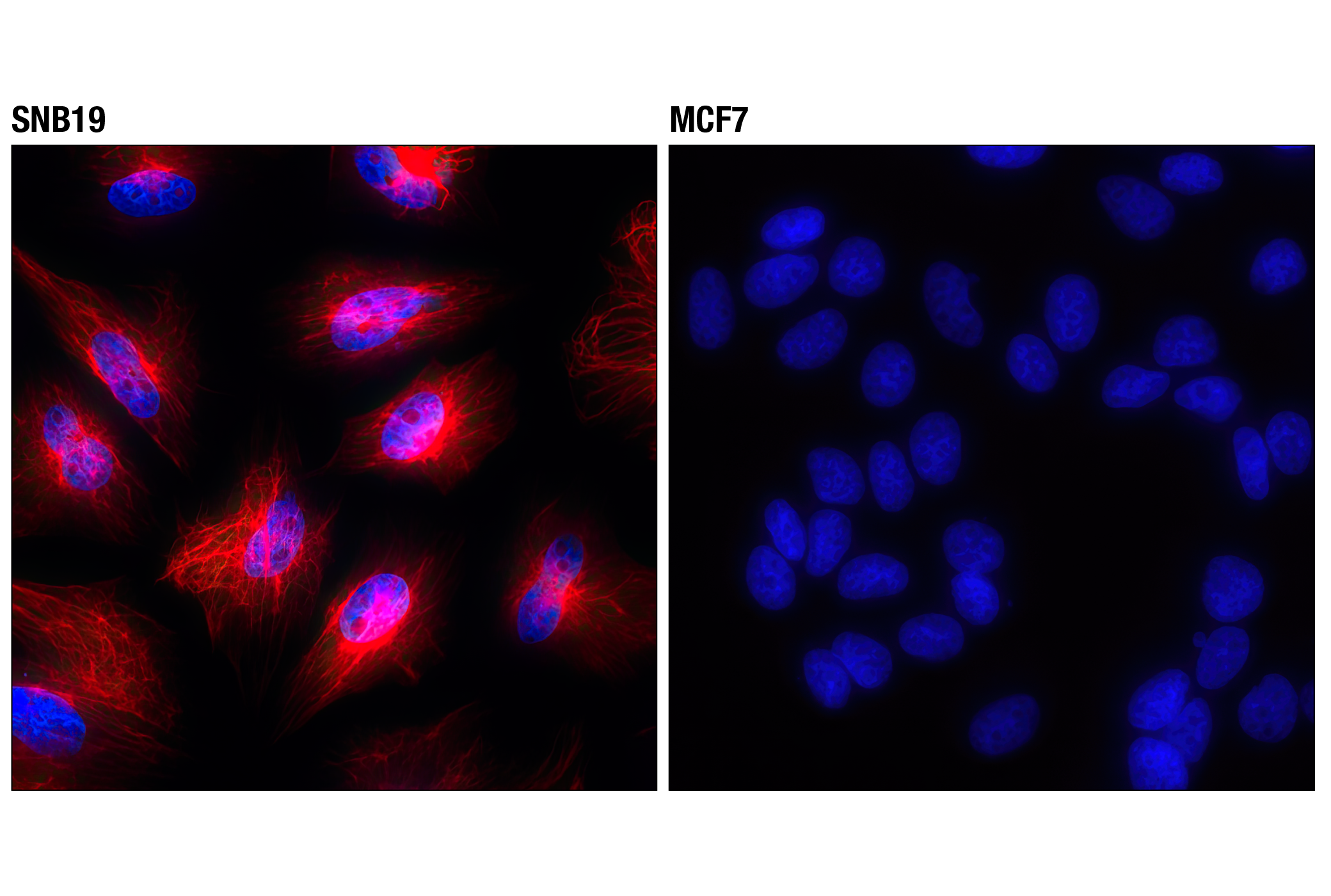 Immunofluorescence Image 1: Vimentin (D21H3) XP® Rabbit mAb (Alexa Fluor® 594 Conjugate)