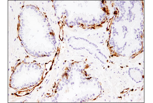 Immunohistochemistry Image 2: CD74 (D5N3I) XP® Rabbit mAb (BSA and Azide Free)