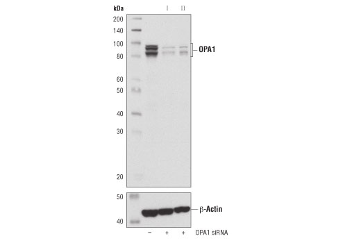  Image 15: Mitochondrial Dynamics Antibody Sampler Kit II