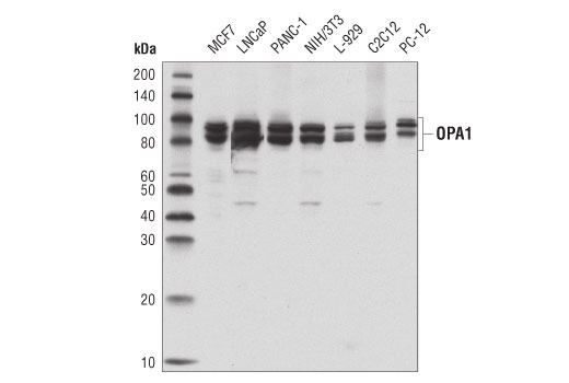  Image 27: Mitochondrial Dynamics Antibody Sampler Kit II