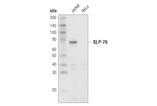 Western Blotting Image 1: SLP-76 (D1R1A) Rabbit mAb (Biotinylated)