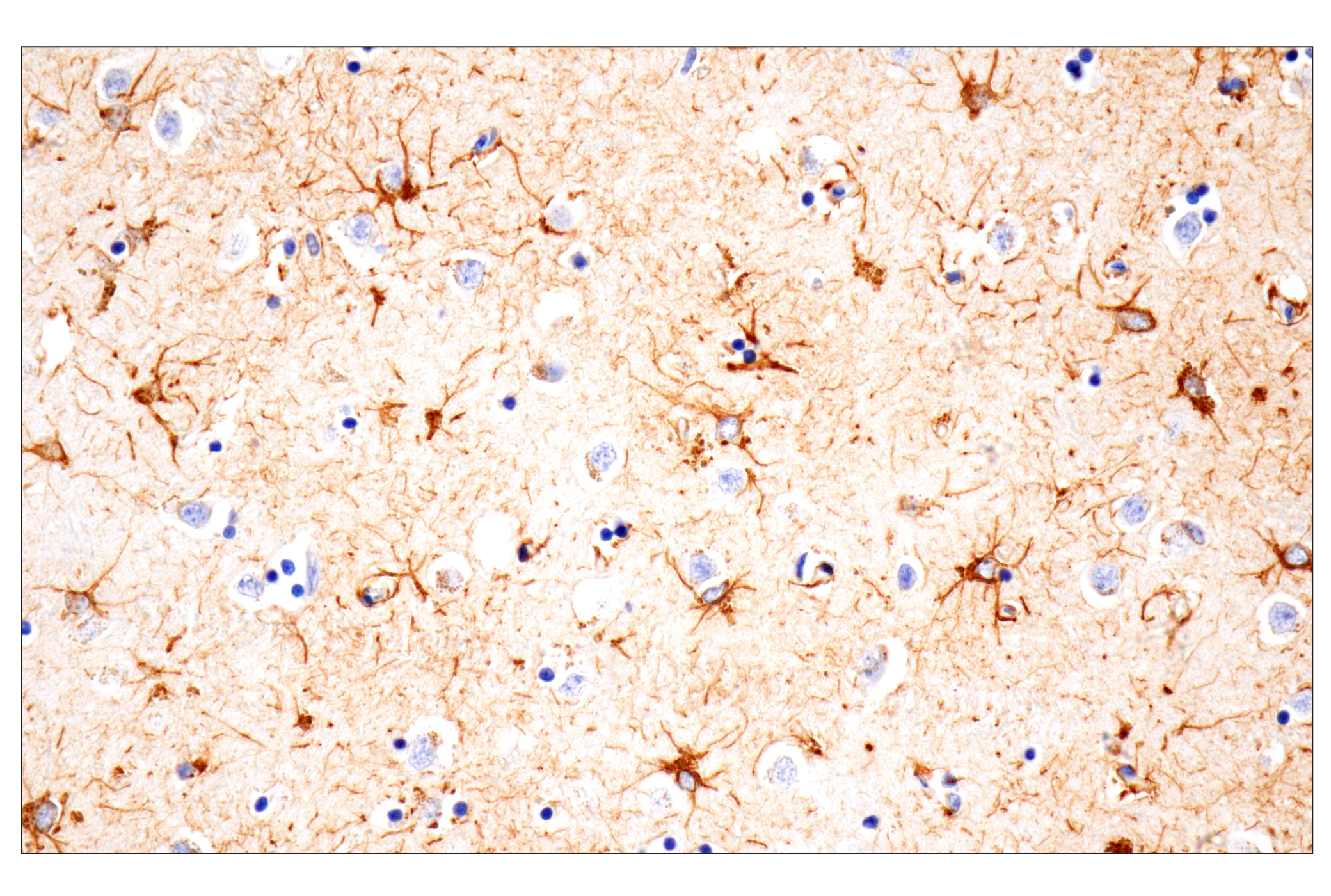  Image 12: Astrocyte Markers Antibody Sampler Kit
