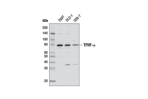 Western Blotting Image 1: TFIIF-α Antibody