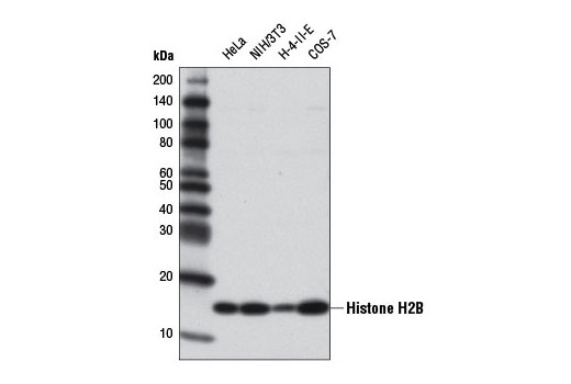 Western Blotting Image 1: Histone H2B (V119) Antibody