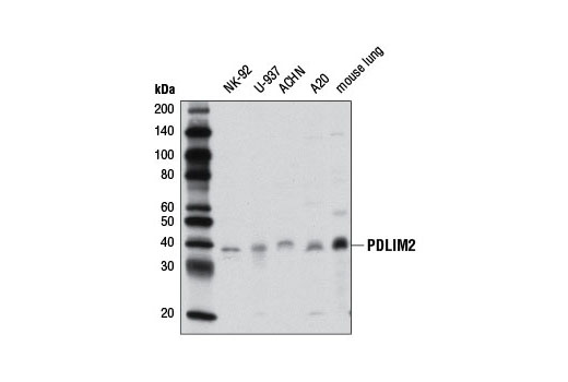 Western Blotting Image 1: PDLIM2 Antibody