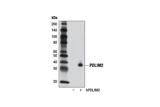 Western Blotting Image 2: PDLIM2 Antibody