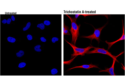 Immunofluorescence Image 1: Acetyl-α-Tubulin (Lys40) (D20G3) XP® Rabbit mAb (Alexa Fluor® 647 Conjugate)