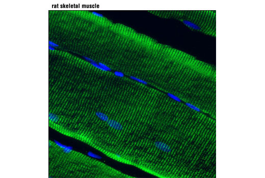 Immunofluorescence Image 1: RyR1 (D4E1) Rabbit mAb