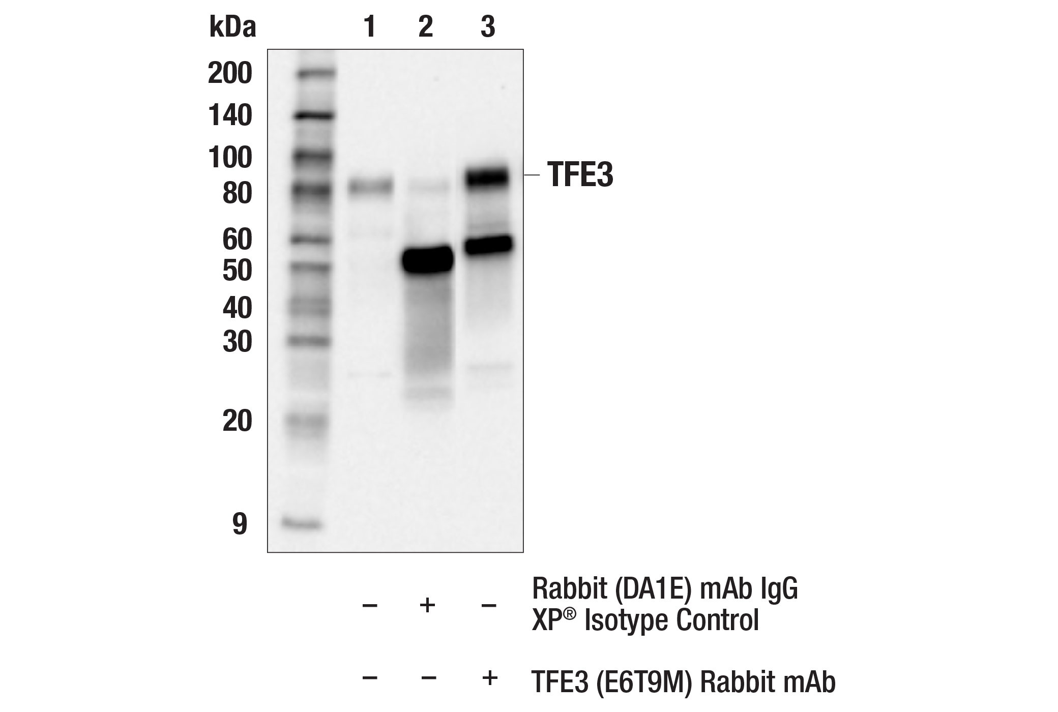 Immunoprecipitation Image 1: TFE3 (E6T9M) Rabbit mAb