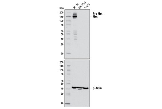  Image 16: Receptor Tyrosine Kinase Antibody Sampler Kit