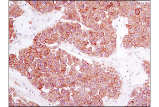  Image 45: Wnt/β-Catenin Activated Targets Antibody Sampler Kit