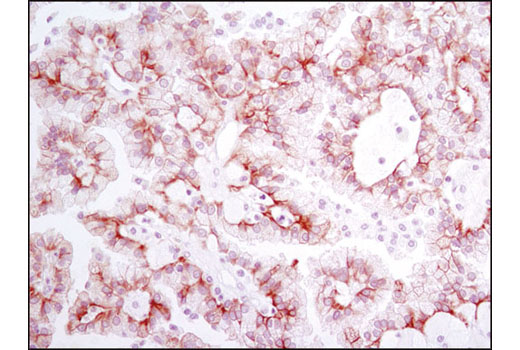  Image 47: Wnt/β-Catenin Activated Targets Antibody Sampler Kit
