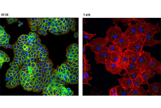  Image 52: Wnt/β-Catenin Activated Targets Antibody Sampler Kit