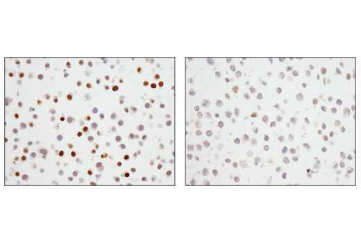 Immunohistochemistry Image 1: p27 Kip1 (SX53G8.5) Mouse mAb (IHC Formulated)
