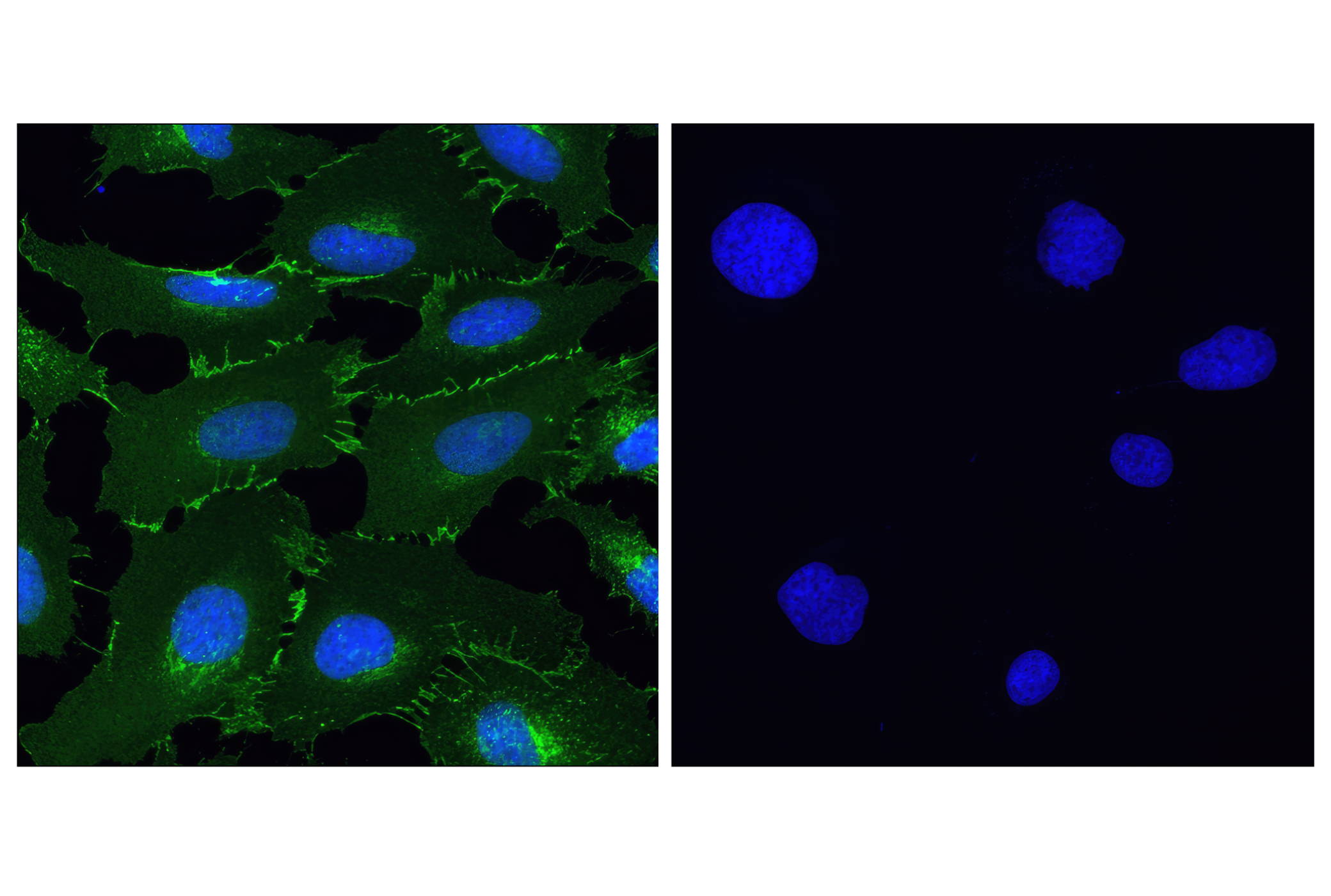 Immunofluorescence Image 2: β-Catenin (D10A8) XP® Rabbit mAb