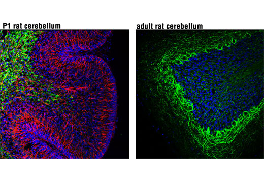 Immunofluorescence Image 1: Nestin (Rat-401) Mouse mAb (Alexa Fluor® 647 Conjugate)