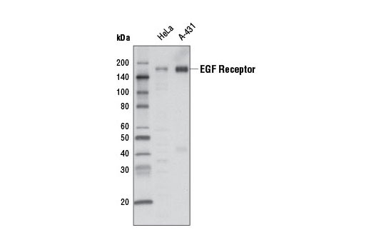 Western Blotting Image 1: EGF Receptor (D38B1) XP® Rabbit mAb (HRP Conjugate)