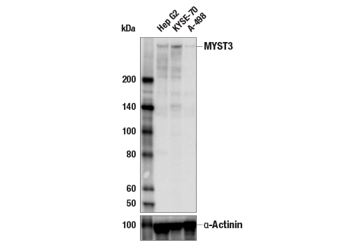  Image 5: MYST Antibody Sampler Kit
