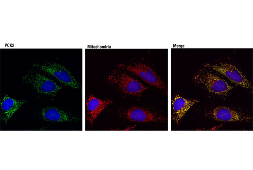 Immunofluorescence Image 1: PCK2 (D3E11) Rabbit mAb