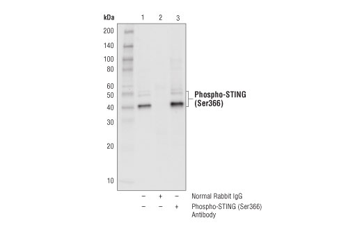 Immunoprecipitation Image 1: Phospho-STING (Ser366) Antibody
