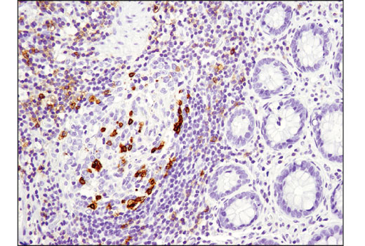 Immunohistochemistry Image 2: PD-1 (Intracellular Domain) (D4W2J) XP® Rabbit mAb
