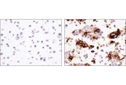 Immunohistochemistry Image 4: PD-1 (Intracellular Domain) (D4W2J) XP® Rabbit mAb