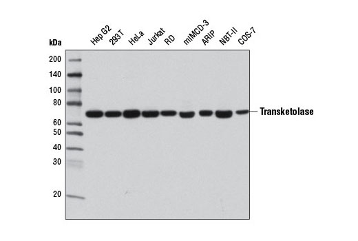 Western Blotting Image 1: Transketolase Antibody