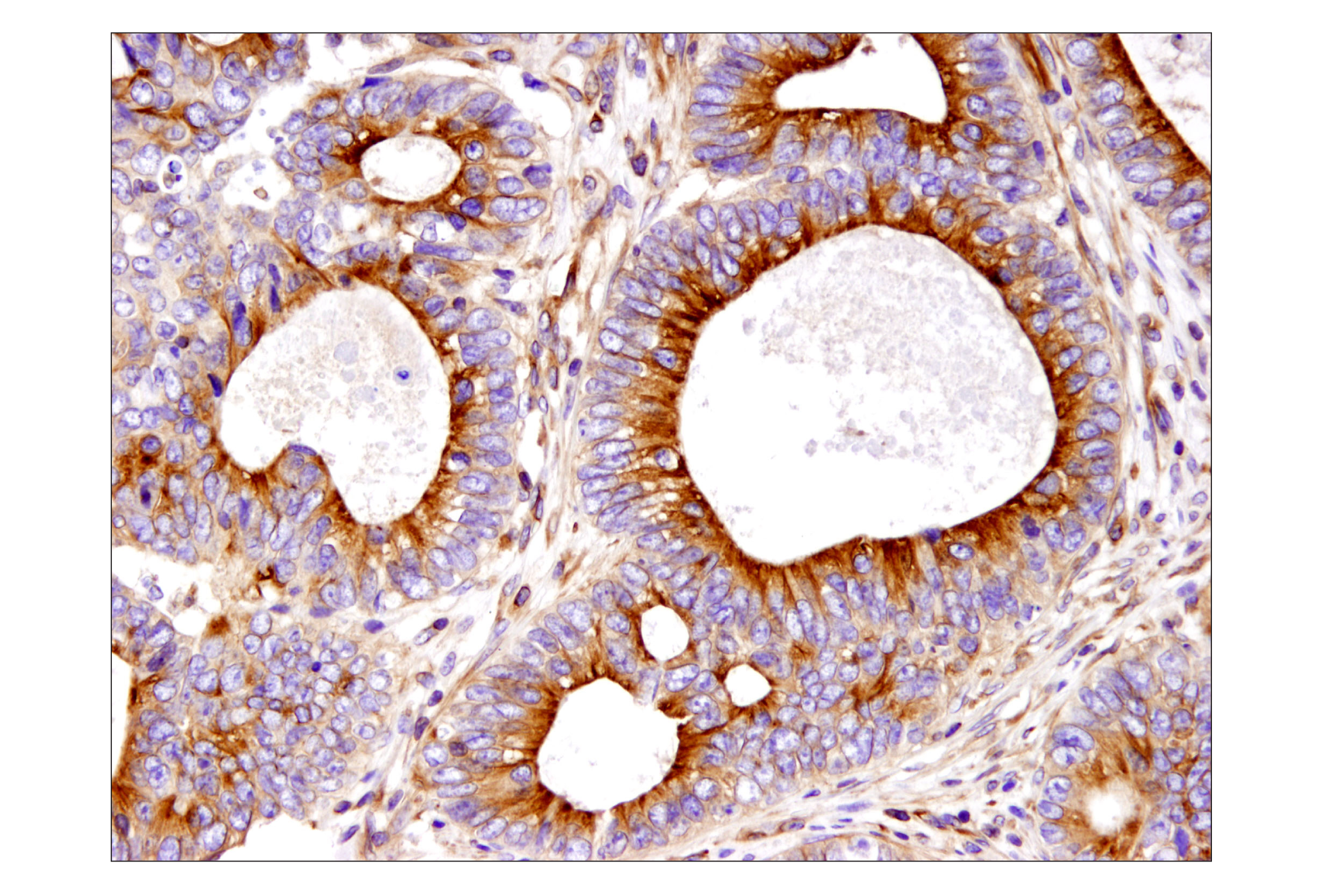 Immunohistochemistry Image 1: β-Tubulin (D3U1W) Mouse mAb