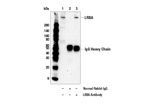 Lrba Antibody Cell Signaling Technology