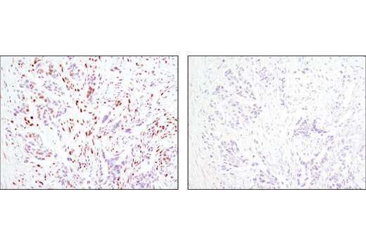 Immunohistochemistry Image 1: CtBP1 (D2D6) Rabbit mAb