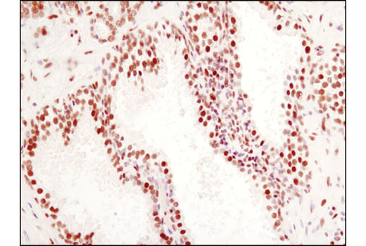 Immunohistochemistry Image 3: CtBP1 (D2D6) Rabbit mAb