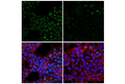 Immunofluorescence Image 1: METTL16 (E2J1D) Rabbit mAb