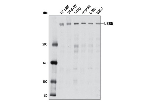 Western Blotting Image 1: UBR5 Antibody