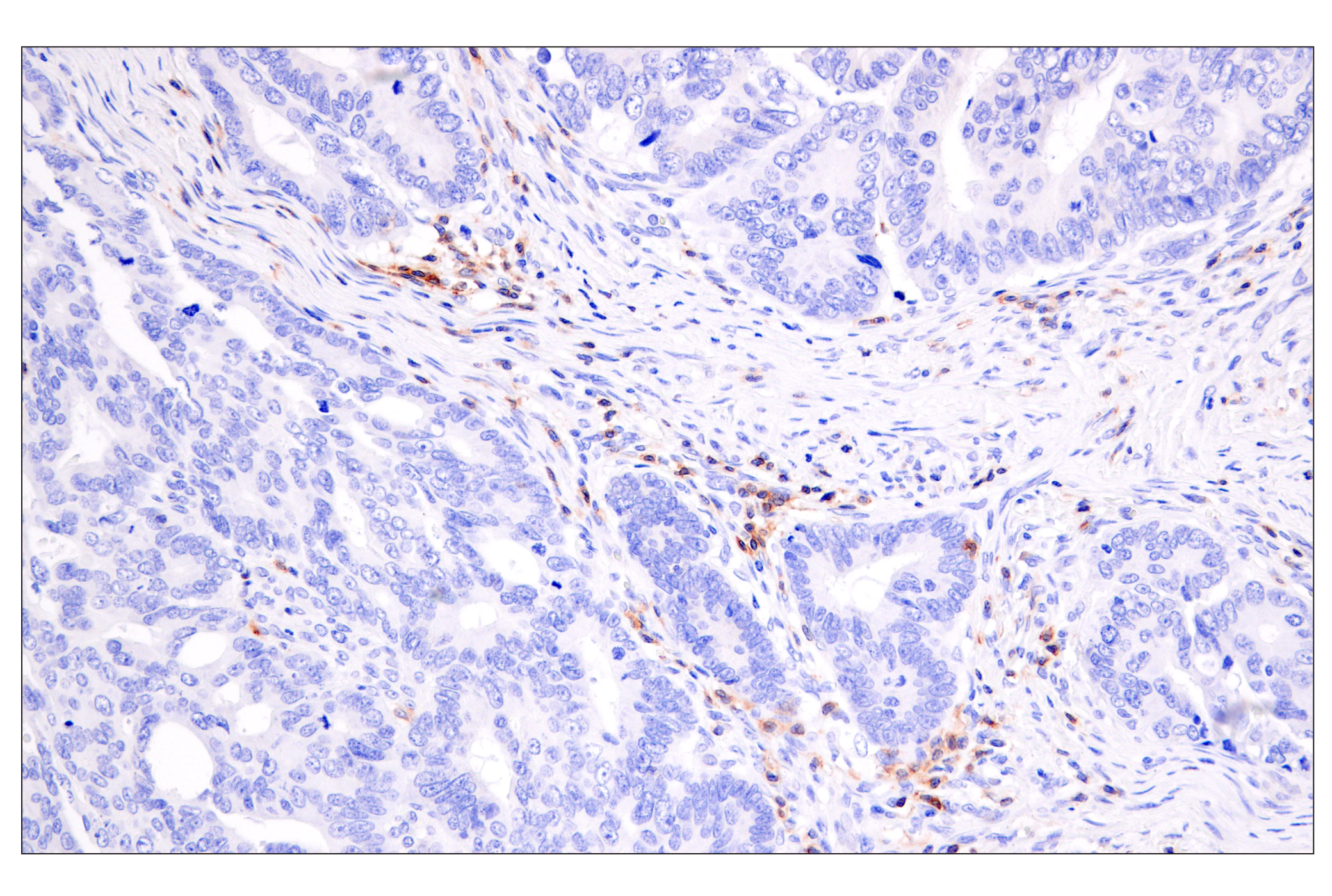 Immunohistochemistry Image 2: CD28 (D2Z4E) Rabbit mAb (BSA and Azide Free)