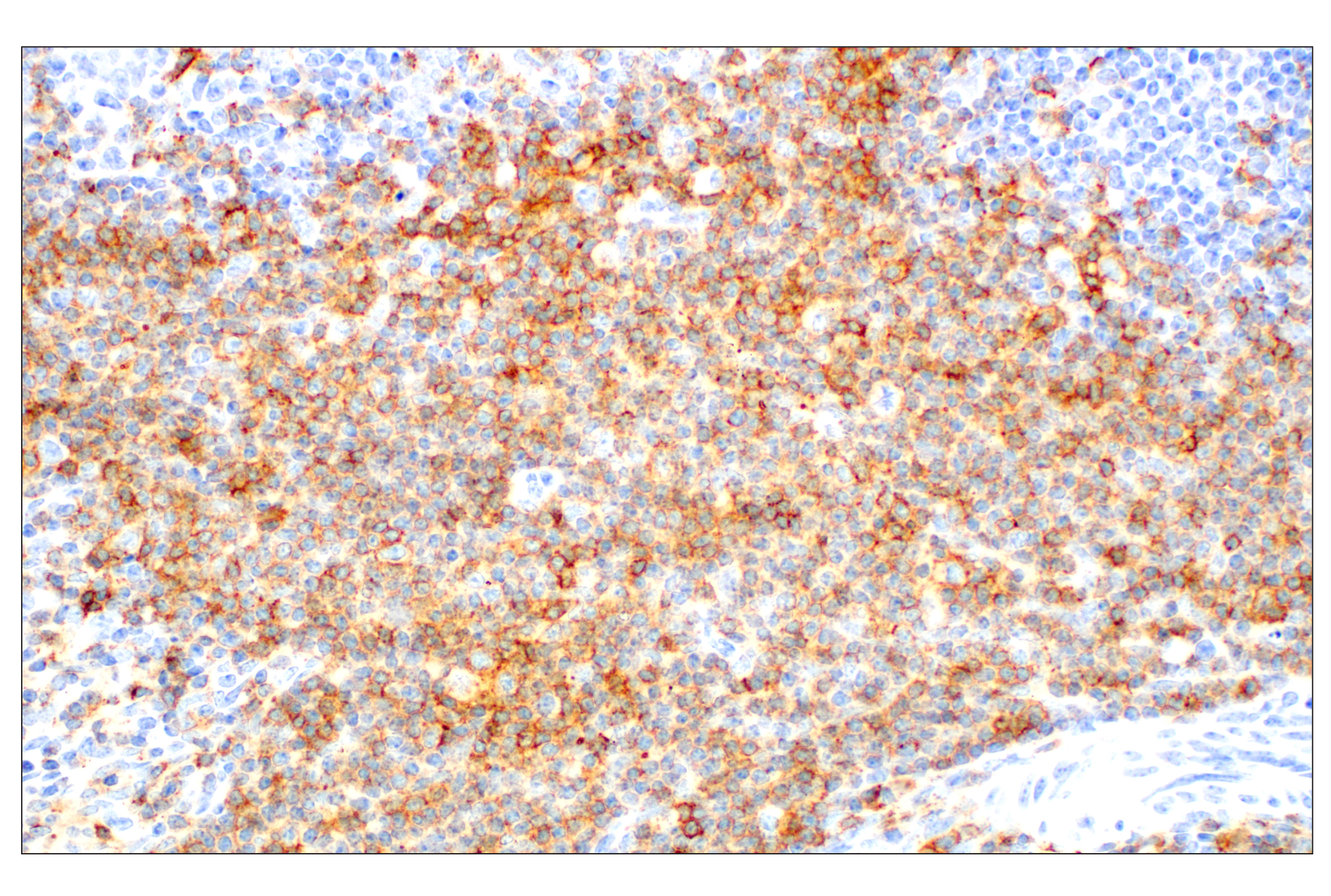 Immunohistochemistry Image 3: CD28 (D2Z4E) Rabbit mAb (BSA and Azide Free)