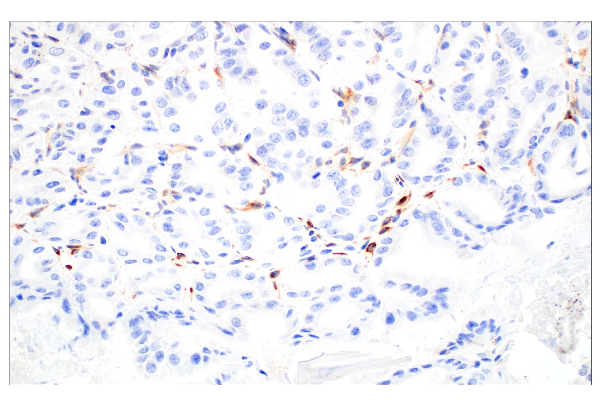 Immunohistochemistry Image 4: CD28 (D2Z4E) Rabbit mAb (BSA and Azide Free)
