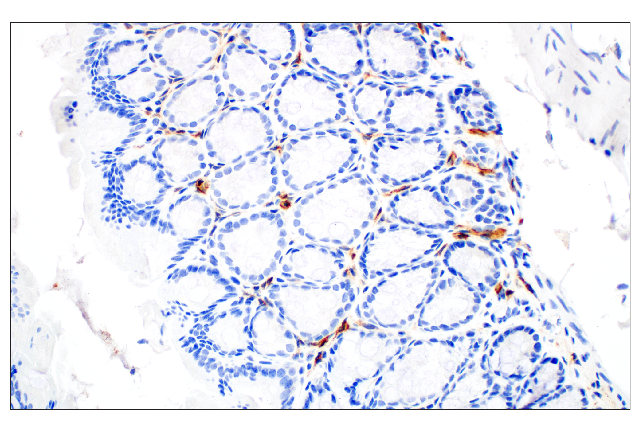 Immunohistochemistry Image 5: CD28 (D2Z4E) Rabbit mAb (BSA and Azide Free)