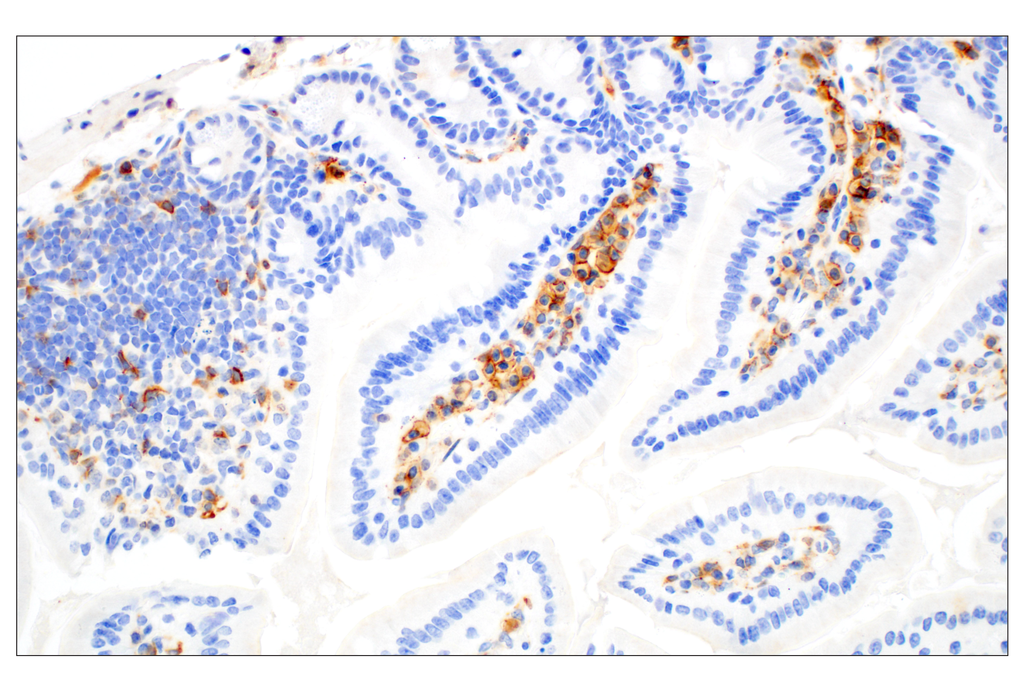 Immunohistochemistry Image 6: CD28 (D2Z4E) Rabbit mAb (BSA and Azide Free)