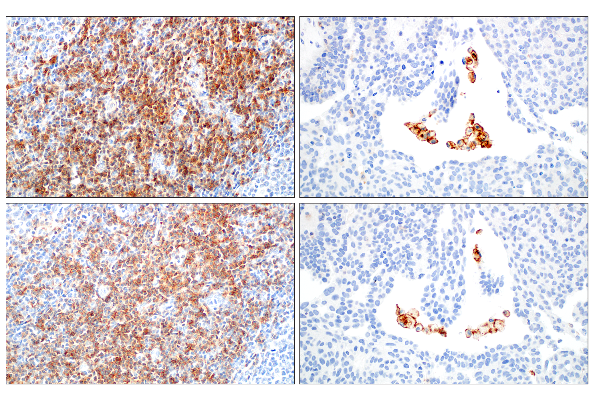 Immunohistochemistry Image 7: CD28 (D2Z4E) Rabbit mAb (BSA and Azide Free)
