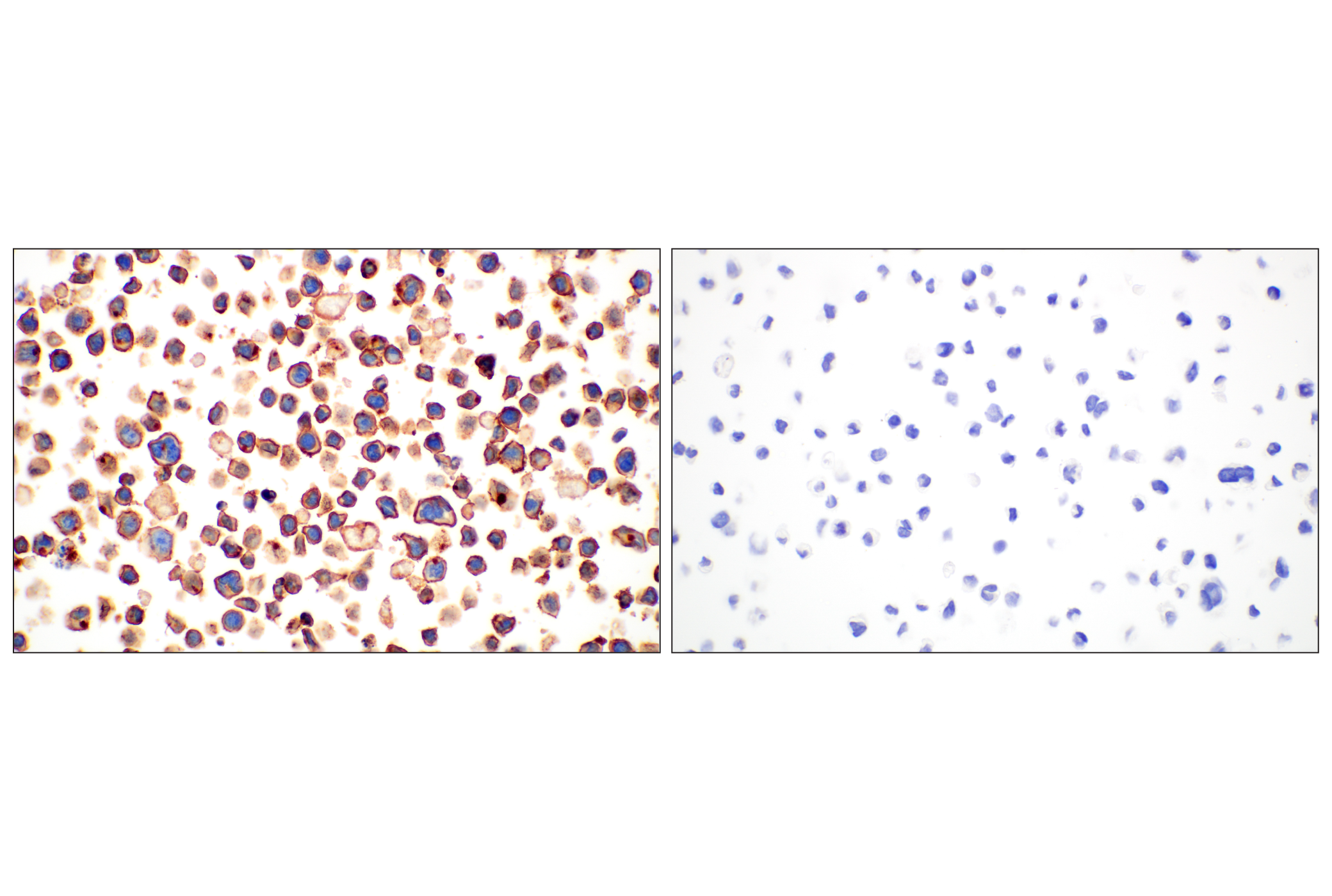 Immunohistochemistry Image 9: CD28 (D2Z4E) Rabbit mAb (BSA and Azide Free)